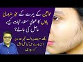 How to remove facial hair  unwanted face hair  tips by hakeem shah nazir