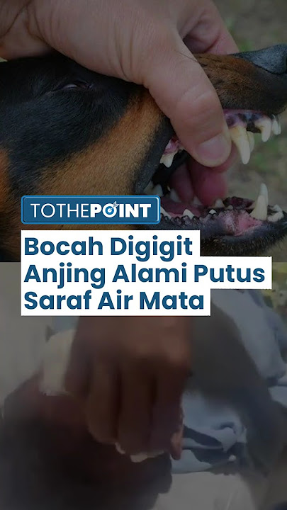 VIRAL Bocah Digigit Anjing Tetangga Alami Putus Saraf Air Mata, Pemilik Anjing Siap Tanggung Jawab
