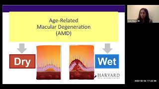 AMD Awareness and Treatments with Dr. Sonia Dhoot