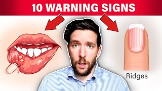 10 WARNING Signs That Your Stomach Acid Is Low