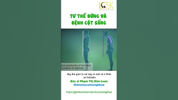 TƯ THẾ ĐỨNG VÀ BỆNH CỘT SỐNG #lamchusuckhoe #cotsongkhoe #trending