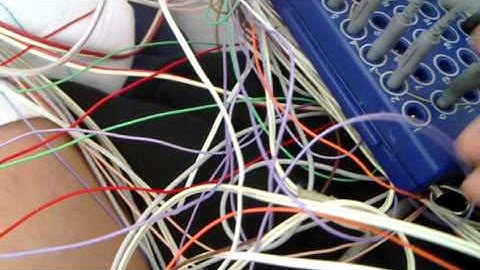 How to use EEG jumper cables to remove EKG Artifact