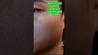 ماسك الشاي الاخضر السحريGREEN لتنظيف البشرة والتخلص من الرؤوس السوداء. التخلص  من حب الشباب واثاره