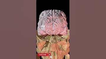 How Does a Concussion Affect Your Brain