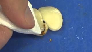 Parts of a Seed 2_Dissection