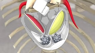 Artificial hearts screenshot 5