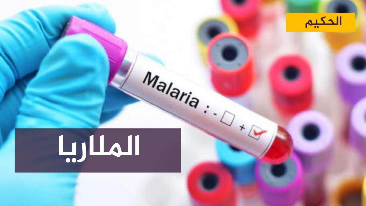 لقاح ضد الملاريا يغير قواعد اللعبة بعد نجاح التجارب