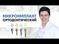 Микроимплант ортодонтический (микровинт) [ что это такое и зачем он нужен? ] #MiniScrew.