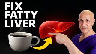 Download Lagu Drink This Before Your Liver Gets Worse – It Helps REVERSE Fatty Liver!  Dr. Mandell MP3 Download Lagu Drink This Before Your Liver Gets Worse – It Helps REVERSE Fatty Liver!  Dr. Mandell MP3