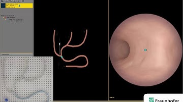 Precise Navigation Through the Vascular System