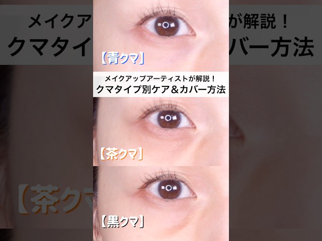 クマのタイプ別！効果的なケア＆カバー方法！