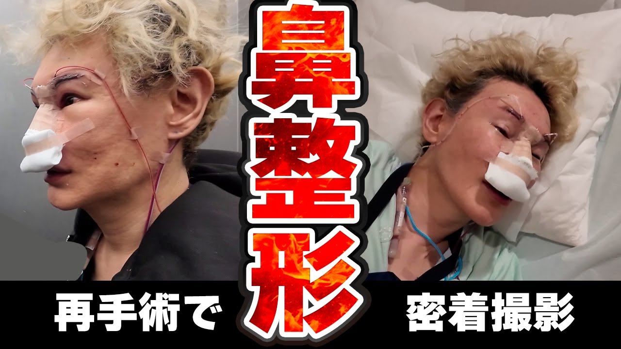 【鼻整形】ついに当日！レジェンド先生による鼻整形に密着【前編】