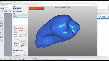 Mesh2Surface: Medical Applications