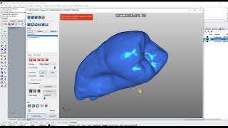Mesh2Surface: Medical Applications