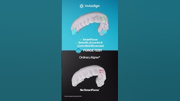 Tried, tested, and trusted aligners from Invisalign