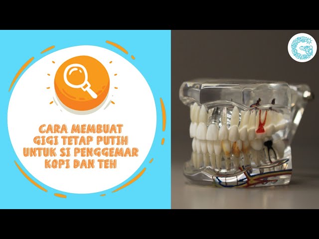 Cara Hentikan Darah Selepas Cabut Gigi Cabut Gigi Batal Puasa Tak / Pin Auf Baju Untuk Dipakai / Adakah batal