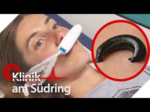 Lebendes Tier in Nase! Es kommt langsam rausgekrabbelt! | Klinik am Südring | SAT.1 TV