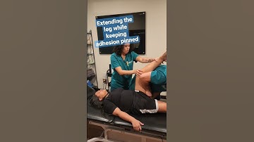 Treating the #sciaticnerve and #femoral nerve (Adhesion Release Methods)