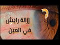 إزالة رايش من العين نصيحة هامةفي آخر الفيديو شاهد للآخر العيون العين Eyes 