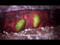 Malaria: Mosquito hospedero | Video HHMI BioInteractive