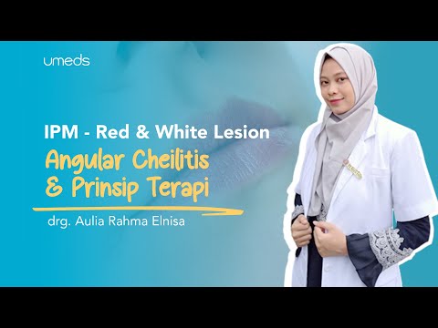 Video: Kapan angular cheilitis sembuh?