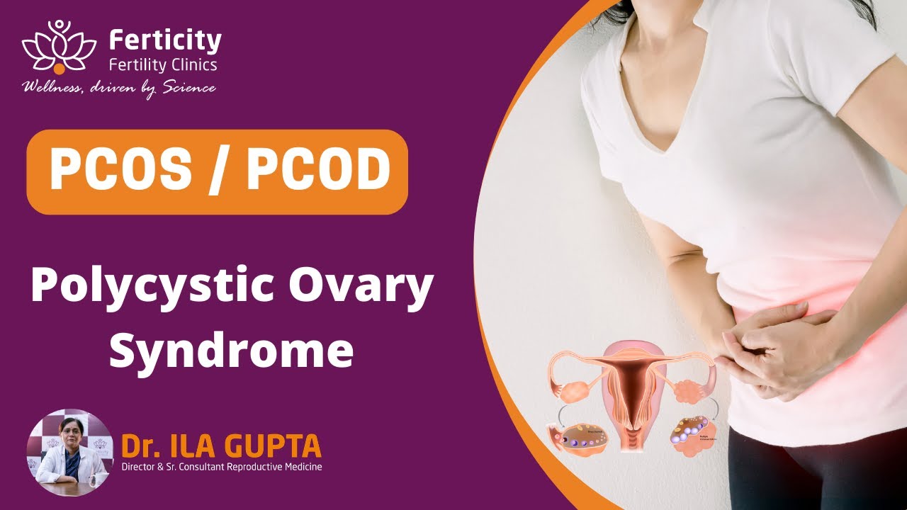PCOS/PCOD Polycystic ovary syndrome | symptoms and treatment | Best IVF center in Delhi | Ferticity