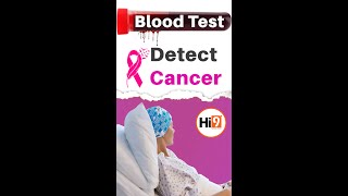 Hi9 | Blood Test Detect Cancer | Cancer | Causes Of Cancer | Blood Cancer | Detection Of Cancer