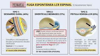 Caso clínico neuroRx  SHI . ROCIO M