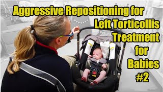#2L Aggressive Repositioning Left Torticollis Treatment: Torticollis Treatment in Babies