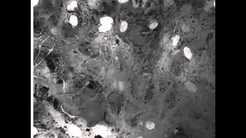 Astrocyte Calcium Communication