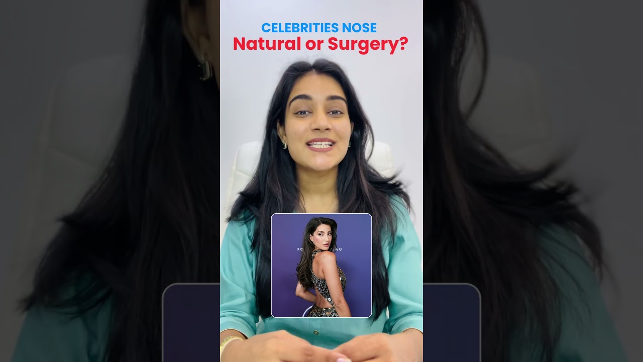 Bollywood Celebrities Nose Surgery vs Natural | Before & After Transformation