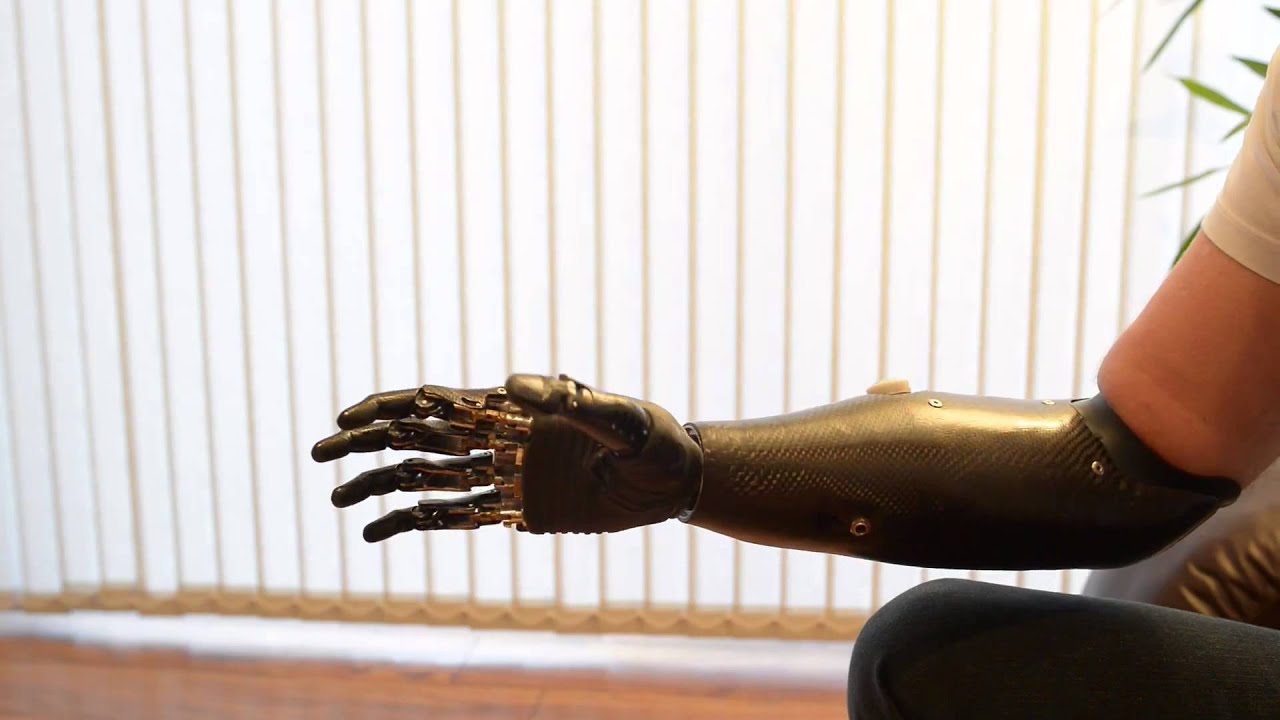 Prosthetic Arm In Spanish at Kimberly Musgrave blog