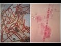 Understanding Polytene Chromosomes and Their Preparation