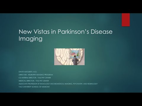 BrainMap: Parkinson’s disease motor severity associated with synaptic density and dopamine ...
