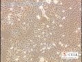 Human Epidermal Keratinocytes: HEK (1)