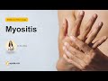 Myositis | Introduction | Neurology Medicine Lectures | V-Learning | sqadia.com