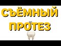 Съемный протез на балке | ЗУБНОЙ ТЕХНИК