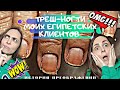 Шок!ТРЕШ-Ногти моих Египетских клиентов!Это нужно увидеть!