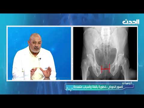 كونسلتو | تطور جراحة العظام والمفاصل في بنغازي وليبيا عامةً