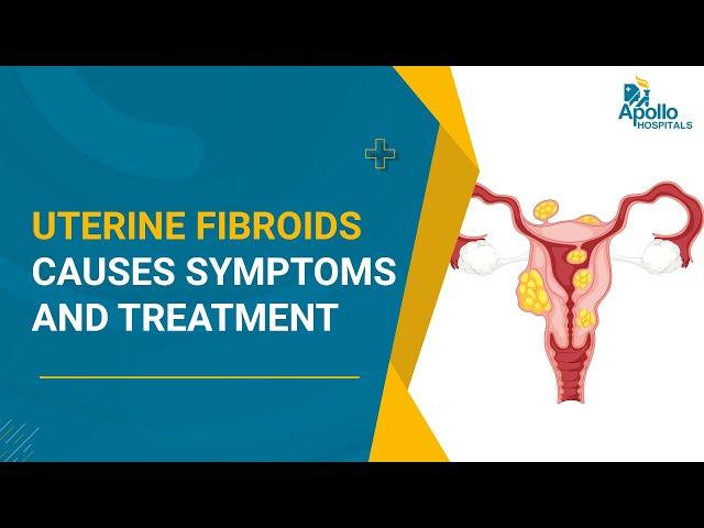 Dr Rooma Sinha Postmenopausal Uterine Bleeding Reasons For dr-rooma-sinha-postmenopausal-uterine-bleeding-reasons-for
