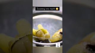 Microscopic View Of Teeth  shortsfeed shorts teeth