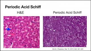Tissue preparation