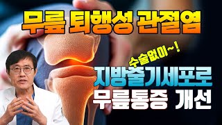 무릎 퇴행성관절염의 지방줄기세포 치료