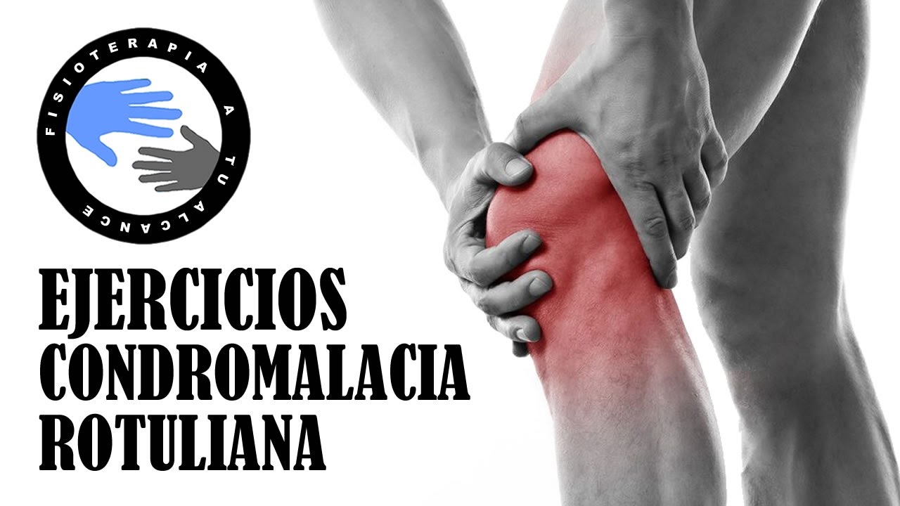 Ejercicios para fortalecer cuadriceps condromalacia rotuliana