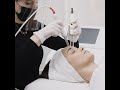 CACI Signature Non-Surgical Facial Toning