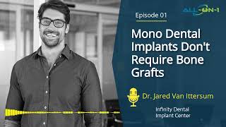 All-on-1 Mono Dental Implants Spring Lake MI!