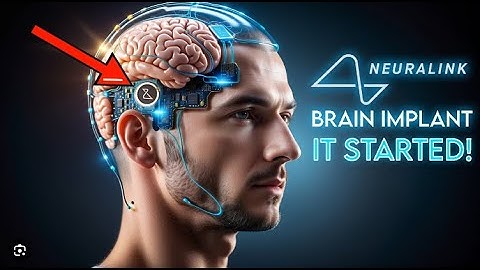Neuralink Decoded: Inside Elon Musk