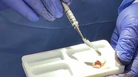 Sticky bone with Powerbone Granules 1 of 2