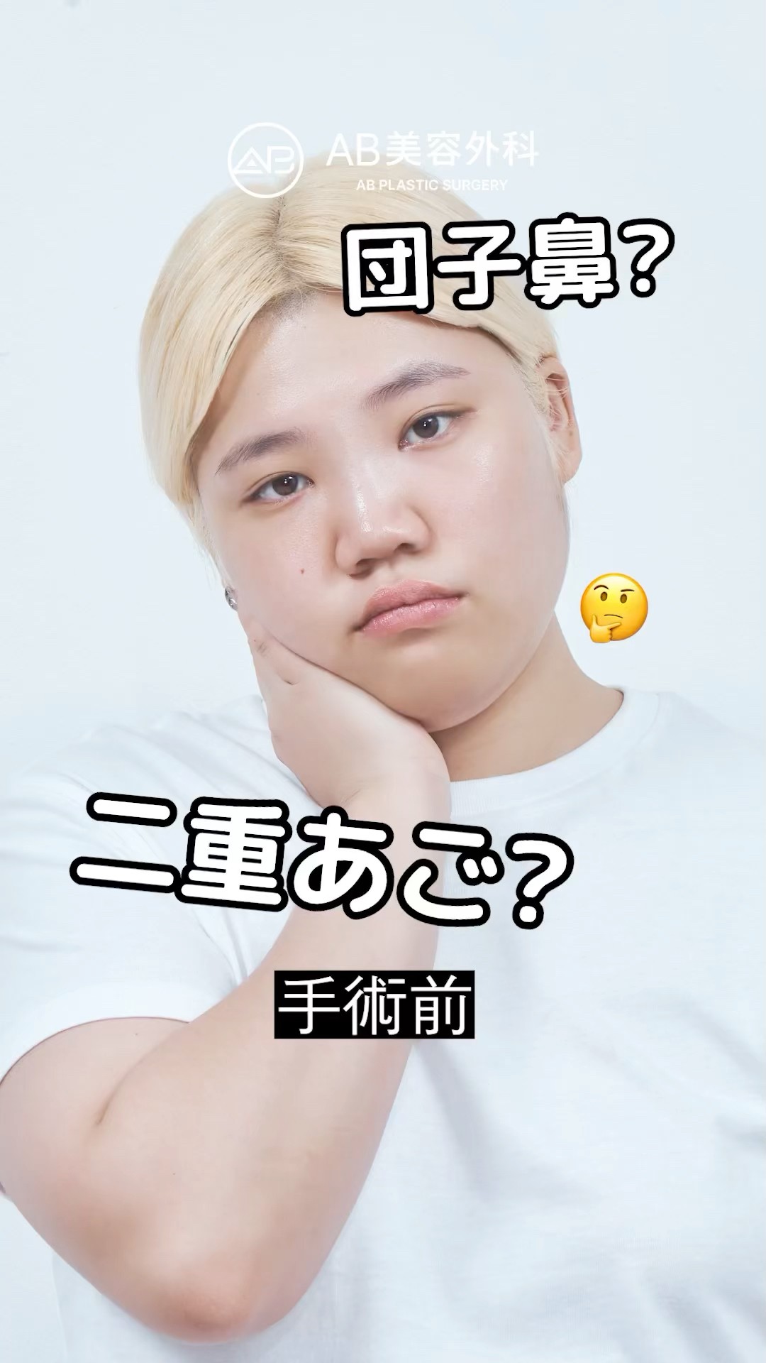 鼻とアゴだけでこんなに変わる？劇的ビフォーアフター！ | AB美容整形