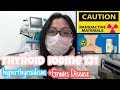 THYROID RADIOACTIVE IODINE -131 THERAPY / GRAVES DISEASE / HYPERTHYROIDISM / Mhay Labrador
